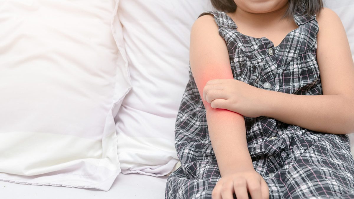 Criança coça braço com lesões da psoríase