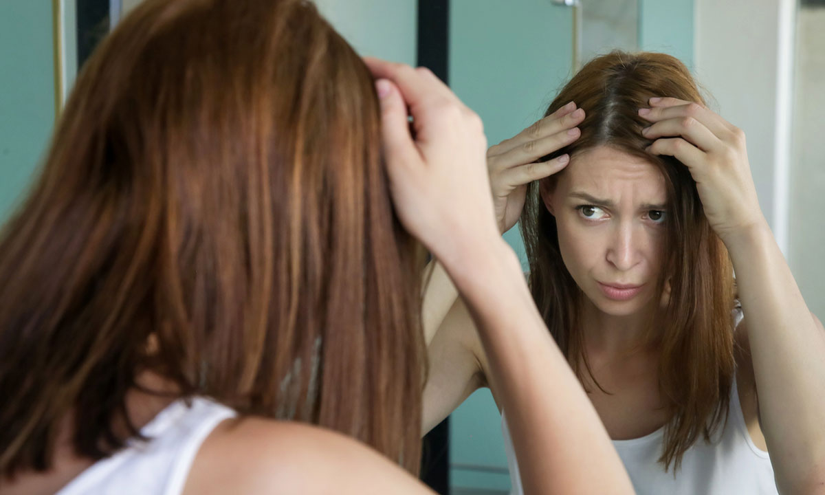 Conheça os 3 tipos mais comuns de calvície feminina