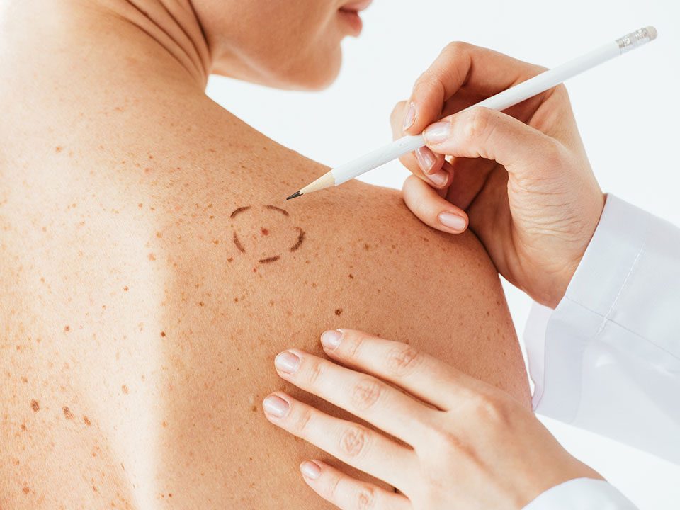 Médico analisando manchas na pele das costas de uma mulher
