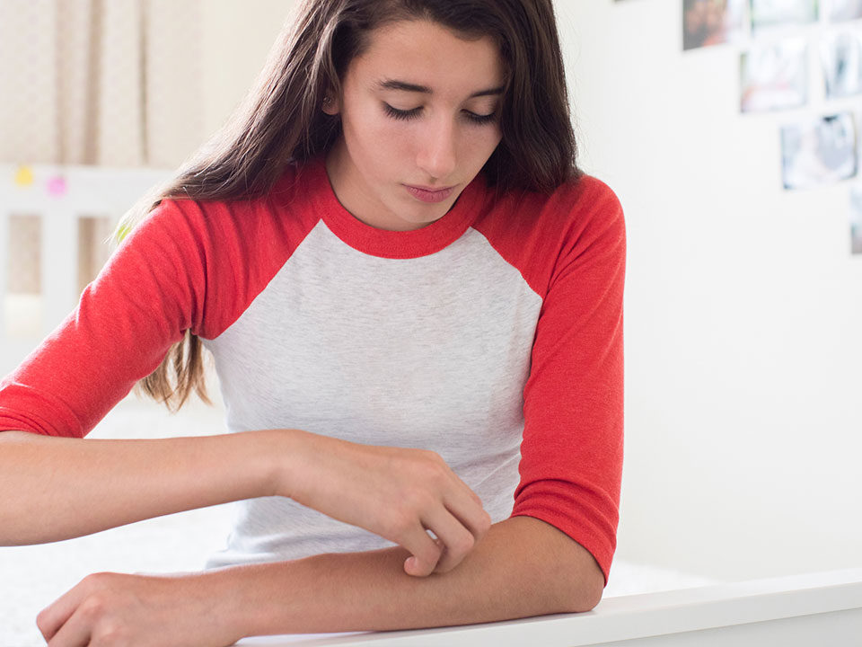 Mulher adolescente com coceira no braço, que pode ser sinal de psoríase
