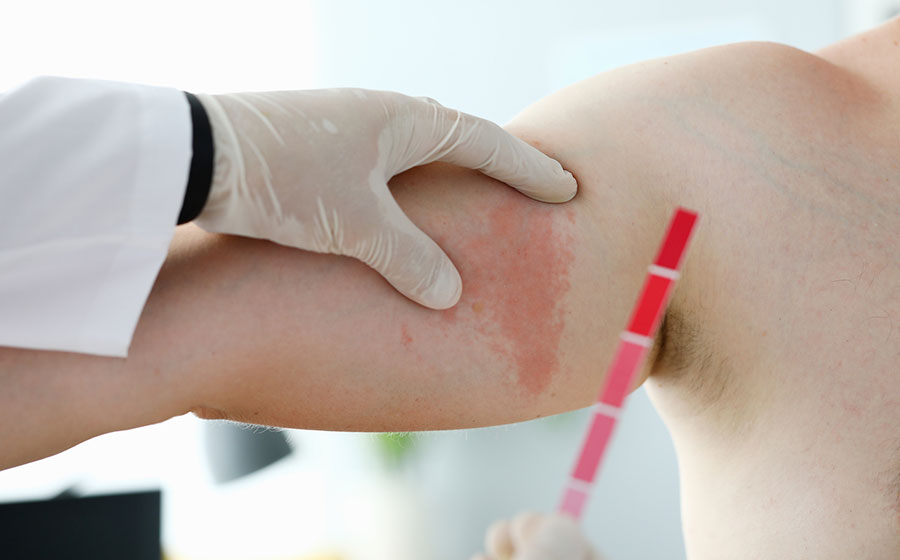 Dermatologista examinando manchas rosas na pele do braço de paciente