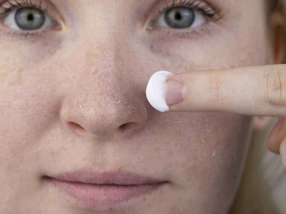 Uma mulher examina a pele seca em seu rosto e passa hidratante no nariz
