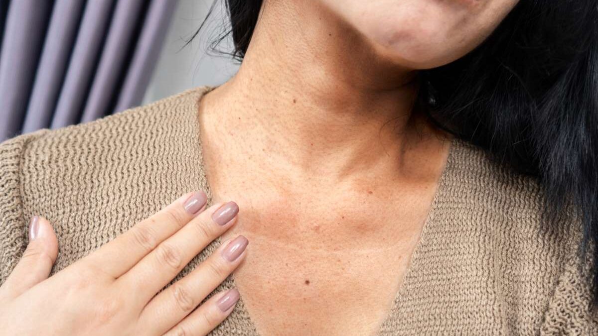 Close-up mulher tendo um problema com rugas pescoço, pele escura, processo de envelhecimento