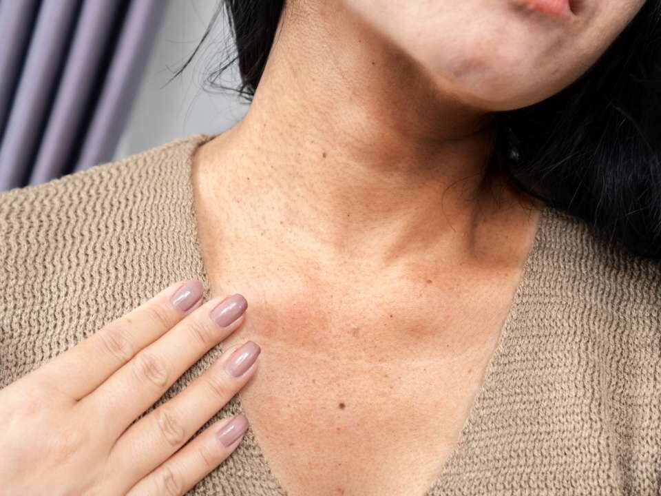 Close-up mulher tendo um problema com rugas pescoço, pele escura, processo de envelhecimento