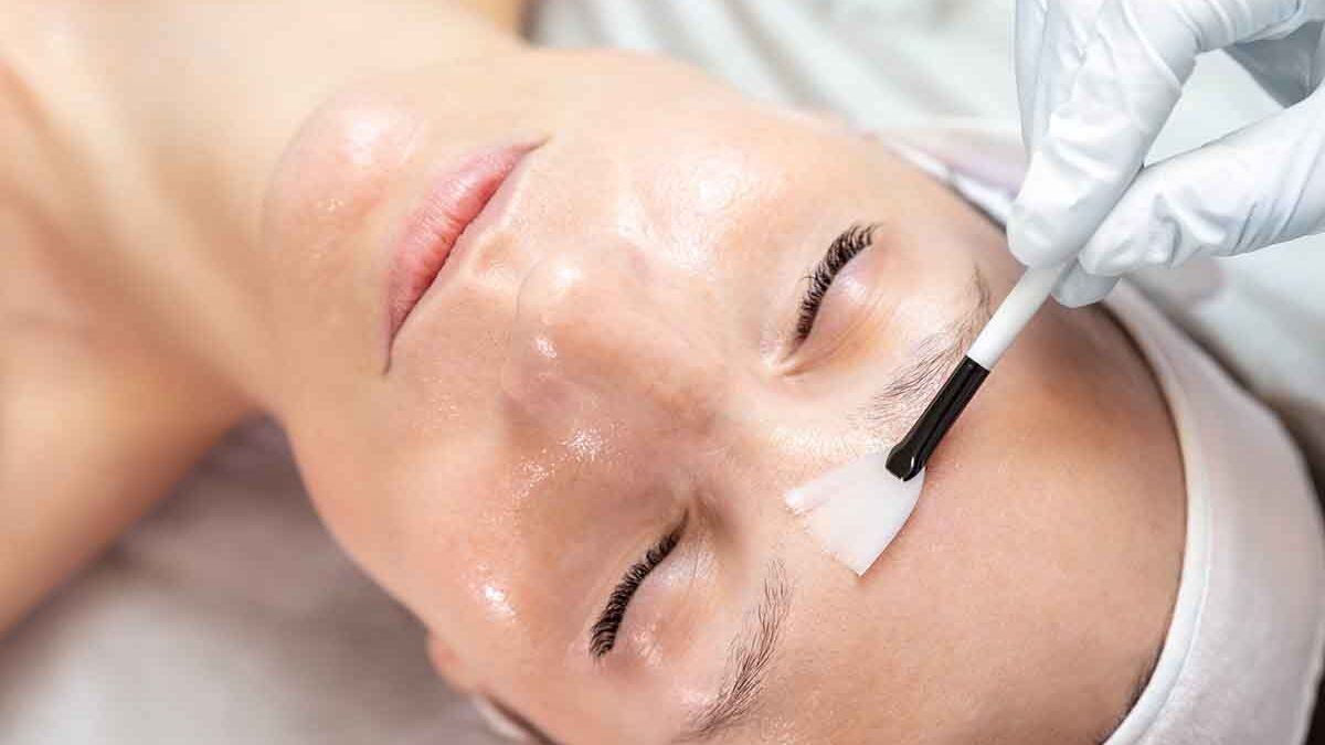 aplicando produto para que ocorra o pelling