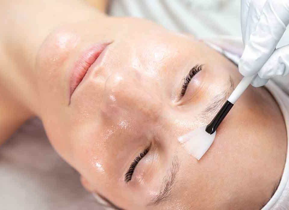 aplicando produto para que ocorra o pelling