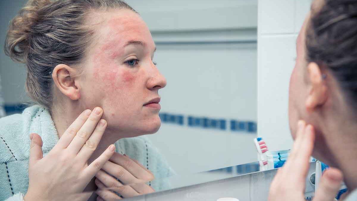 Mulher olhando suas alergias na pele