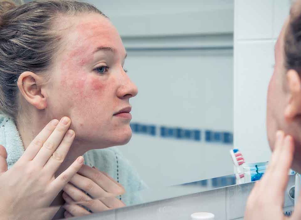 Mulher olhando suas alergias na pele