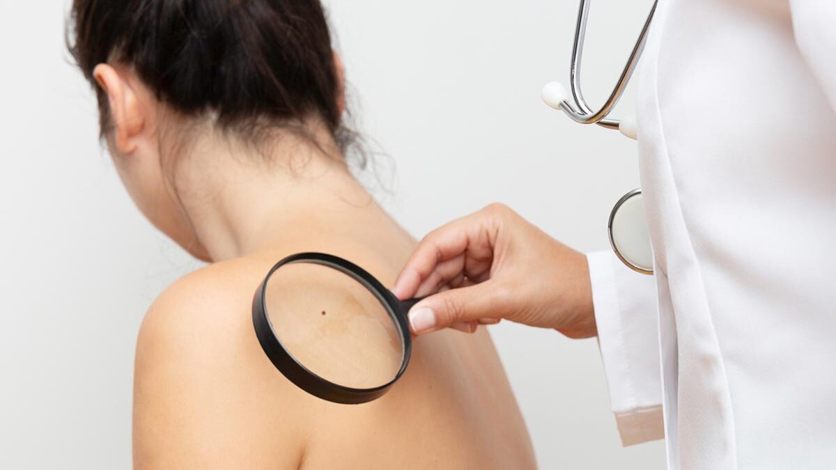 Especialista analisando alguns sinais na pele