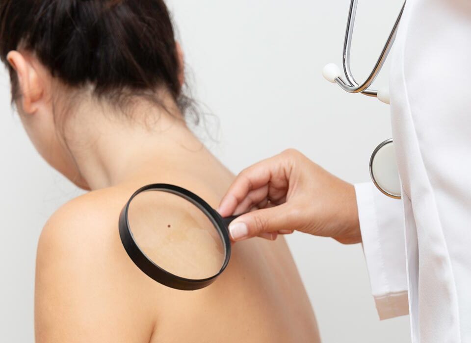 Especialista analisando alguns sinais na pele